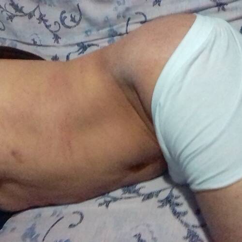 Foto extra 1