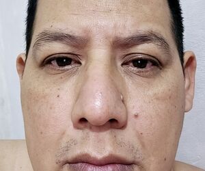Reynaldo nerio